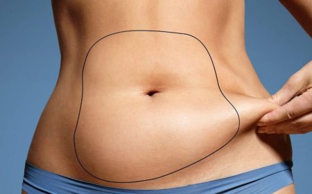 What Liposuction Really Involves Best Surgeons in Dubai Share Their Insights