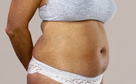 Understanding Abdominoplasty in Dubai: What’s Involved in the Procedure