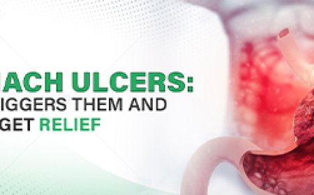 Stomach Ulcers: What Triggers Them and How to Get Relief