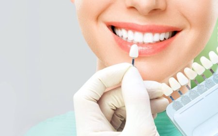 How to Maintain Your Veneers for Long-Term Smile Perfection in Dubai