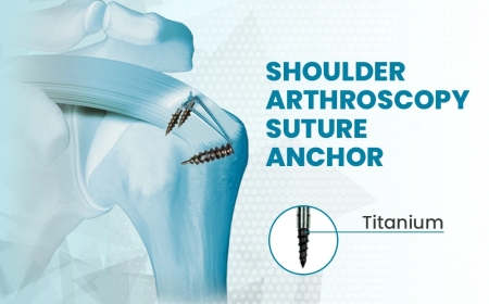 Shoulder Arthroscopy Surgery: A Complete Recovery Guide