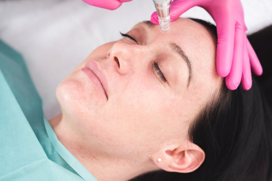 Rejuvenate Your Radiance Discovering the Best Skin Clinic in Richmond