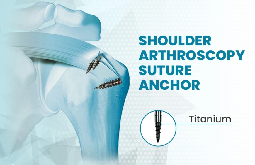 Shoulder Arthroscopy Surgery: A Complete Recovery Guide